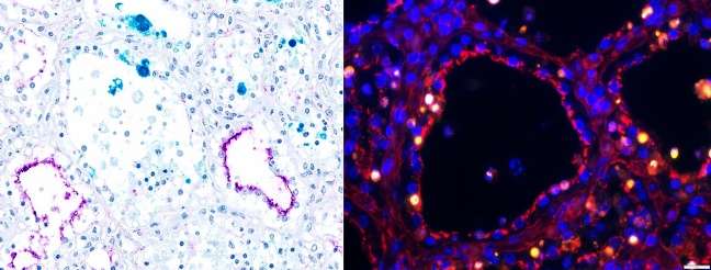 Article: Receptors make dairy cows a prime target for influenza, ISU team finds